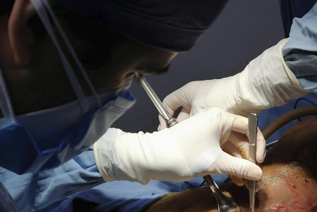 Hernias de pared abdominal